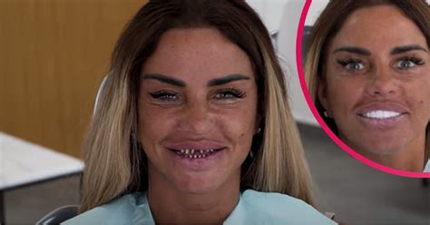 katie price teeth before and after|Katie Price exposes huge gap after her tooth falls out。